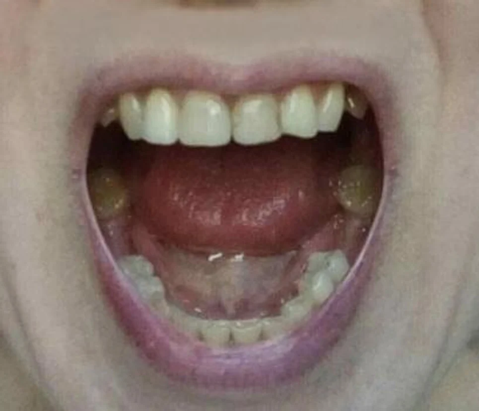 image-3