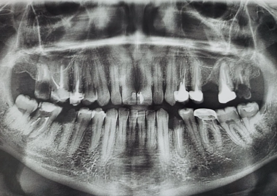 image-1
